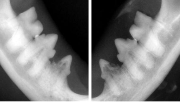 Resorptive Lesions