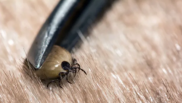 How to Remove a Tick