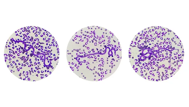 Heartworm in Southern Ontario