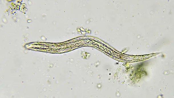 What You Need to Know About Pinworms